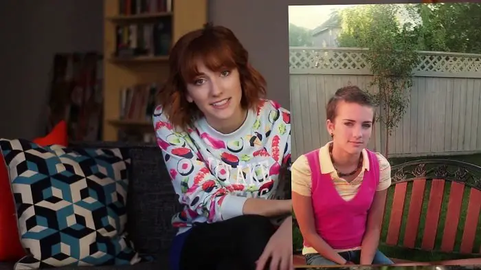 Julie Nolke pointing to a younger photo of herself some months after going bald.