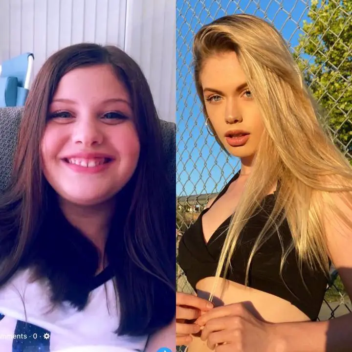 Maddie Dean was bullied for being over weight.
