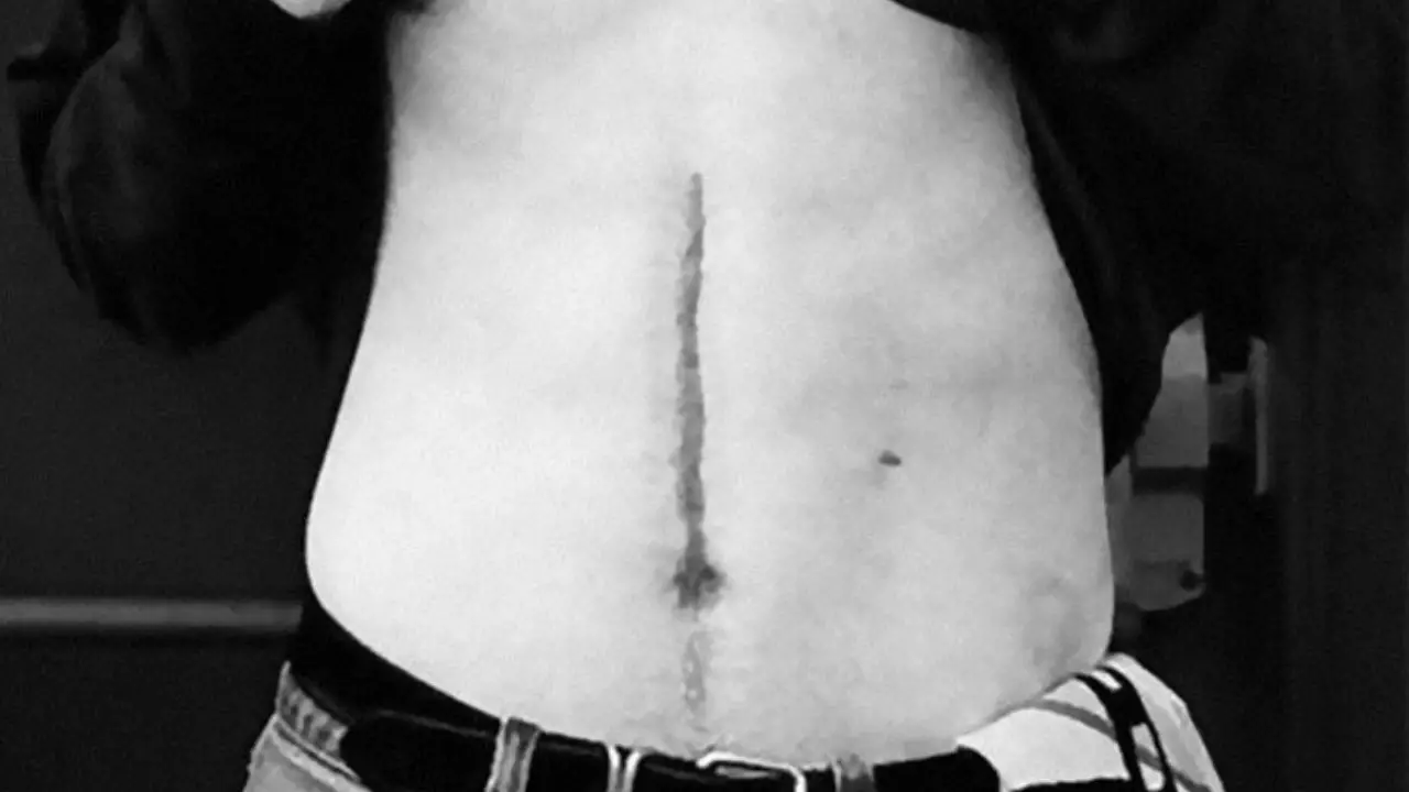 Keanu Reeves stomach scar celebsfortune.com